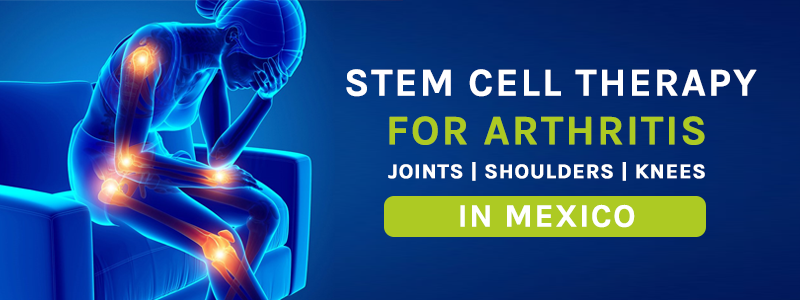 Stem Cell Therapy for Arthritis (Joints/Shoulders/Knees) in Mexico