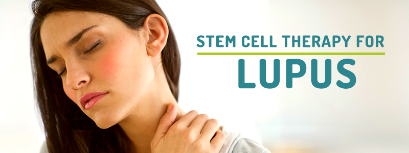 Stem Cell Therapy for Lupus